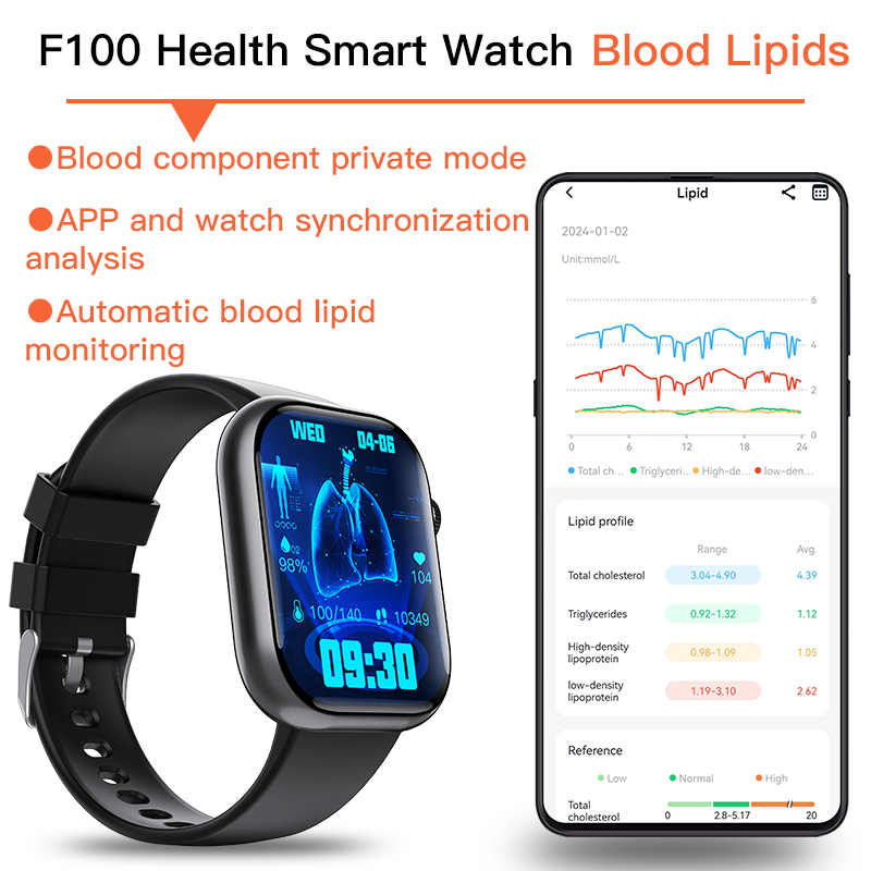 Best ECG Smart Watch of 2025 With Blood Pressure Monitor+Blood Glucose Monitoring Wautton Outdoor Gear